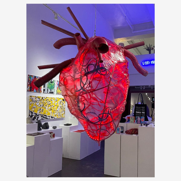 ART – Static Heart